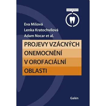 Projevy vzácných onemocnění v orofaciální oblasti - Lenka Kratochvílová, Eva Míšová, Adam Nocar