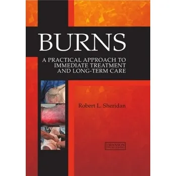 Burns - Sheridan, Robert L.
