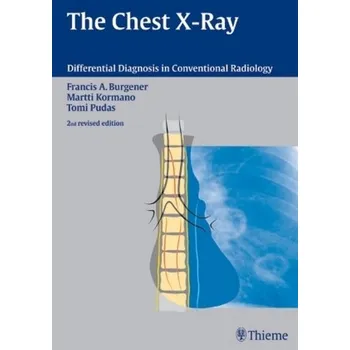 The Chest X-Rays - Burgener, Francis A.