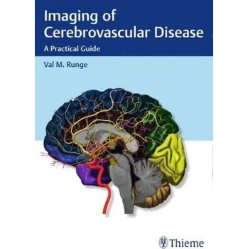Imaging of Cerebrovascular Disease - Runge, Val M.