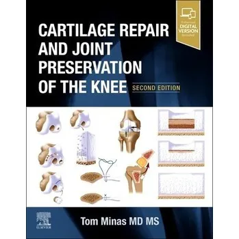 Cizojazyčná kniha Cartilage Repair and Joint Preservation of the Knee - Minas, Tom (Associate Professor, Department of Orthopaedic Surgery, Harvard Medical School, Director, Cartilage Repair Center, Brigham and Women's Hospital, Boston, MA)
