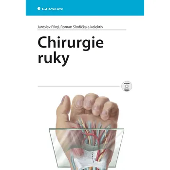 Chirurgie ruky