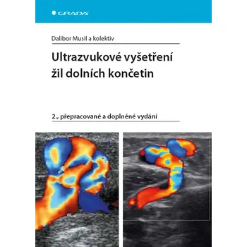 Ultrazvukové vyšetření žil dolních končetin