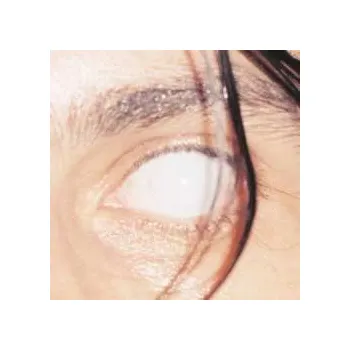 Zahraniční hudba LP Armlock: Trust (ltd. Onyx Marble Vinyl) 2025