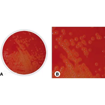 Hnojivo Krevní agar (základ) (Popis: pro mikrobiologii, Balení: 500 g, Obal: plast)