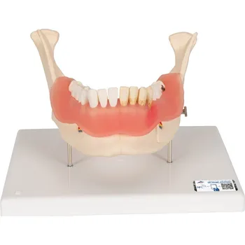 Model zubních chorob