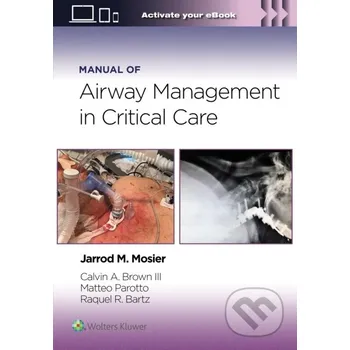 Manual of Airway Management in Critical Care - Raquel Rae Bartz, Jarrod Mosier, Calvin A Brown III, Matteo Parotto Wolters Kluwer Health