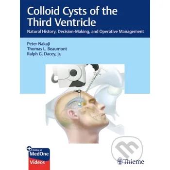 Colloid Cysts of the Third Ventricle - Peter Nakaji, Ralph Dacey, Thomas Beaumont Thieme Medical Publishers