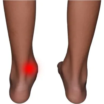 Vložka do bot VV Design MEDIAL - valgozita kotníků Velikost: 21 (EU 32)