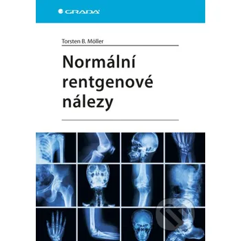 Kniha Normální rentgenové nálezy - Möller Torsten B. Grada