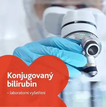 Diagnostický test Konjugovaný bilirubin - laboratorní vyšetření