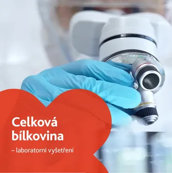 Diagnostický test Celková bílkovina - laboratorní vyšetření