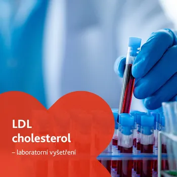 Diagnostický test LDL cholesterol - laboratorní vyšetření