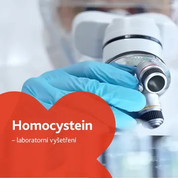 Diagnostický test Homocystein - laboratorní vyšetření
