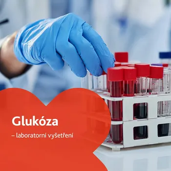 Diagnostický test Glukóza - laboratorní vyšetření