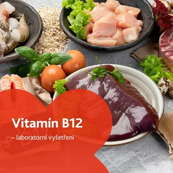Diagnostický test Vitamín B12 - laboratorní vyšetření