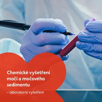Diagnostický test Chemické vyšetření moči a močového sedimentu - laboratorní vyšetření