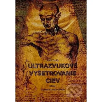 Ultrazvukové vyšetrenie ciev 2. prepracované vydanie - Emil Tvrdík DANSTA