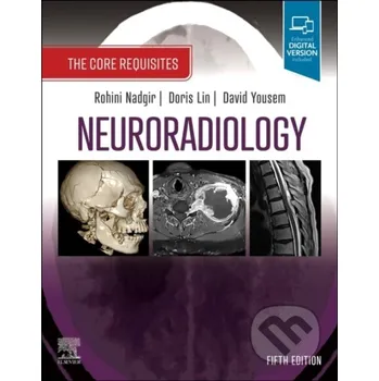Neuroradiology - Rohini Nadgir, Doris Lin, David M. Yousem Elsevier Science