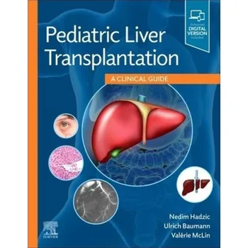 Pediatric Liver Transplantation, A Clinical Guide - Hadzic, Nedim;Baumann, Ulrich (Consultant Paediatric Hepatologist);MCLIN, Valerie