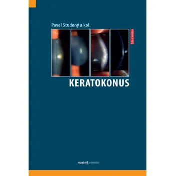 Keratokonus - Pavel Studený