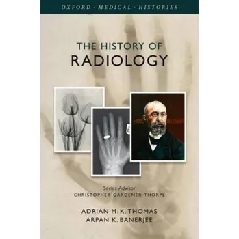 History of Radiology – Adrian M K Thomas (EN)