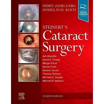 Steinert's Cataract Surgery – Sumit Garg,Douglas D. Koch (EN)