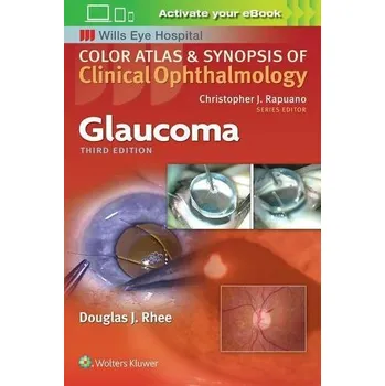 Glaucoma - Rhee, Douglas [EN] (2018, Brožovaná, Lippincott Williams and Wilkins)