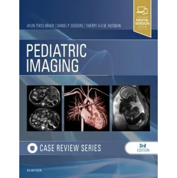 Pediatric Imaging: Case Review Series – Aylin Tekes-Brady,Daniel P. Seeburg,Thierry A. G. M. Huisman (EN)
