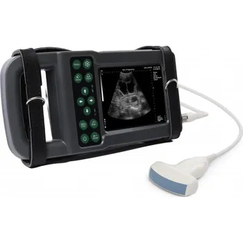 XUZHOU KAIXIN ELECTRON Ultrazvukový skener KX5600L s digitální abdominální sondou