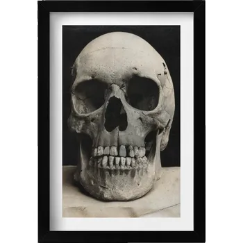 Obraz Elegantní obraz do obýváku v černém rámu Lidská lebka kostra 20x30 cm