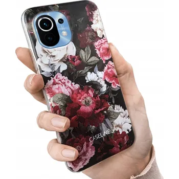 Pouzdro na mobilní telefon Zadní Kryt Caseline pro Xiaomi Mi 11 Lite 5G bezbarvý