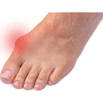 Vložka do bot VV Design Komfort Delux - Hallux Valgus Velikost: 29 (EU 43-44)
