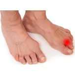 VV Design BON PED+ Kladívkové prsty Velikost: 26 (Fr.č. 39)