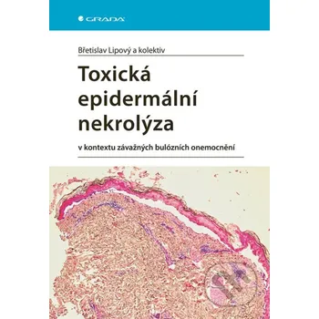 Kniha Toxická epidermální nekrolýza - Břetislav Lipový Grada