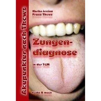 Zungendiagnose in 54 Bildern - Thews, Franz
