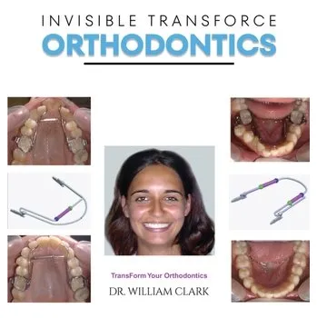 Invisible TransForce Orthodontics - Clark, William Roberts [EN] (2024, Taschenbuch, Austin Macauley Publishers)