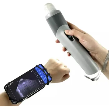 Ultrazvukový scanner W3 s abdominální sondou, bezdrátový