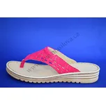 Pantofle meziprst ORTO PLUS 4080 IV růžová (Pantofle meziprst dámský)