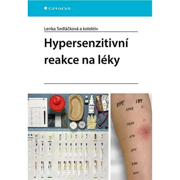 Hypersenzitivní reakce na léky Kniha