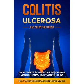 Colitis ulcerosa - Das Selbsthilfebuch: Von der Diagnose über die Therapie und den Umgang mit Colitis ulcerosa im Alltag bis zur - Baumfink, Maria [DE] (2023, Brožovaná, Edition Lunerion)
