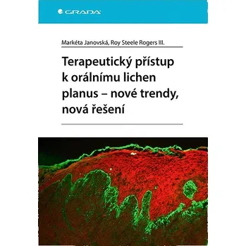 Terapeutický přístup k orálnímu lichen planus - nové trendy, nová řešení Kniha