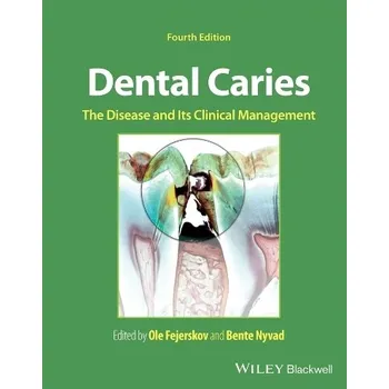 Cizí jazyk Dental Caries