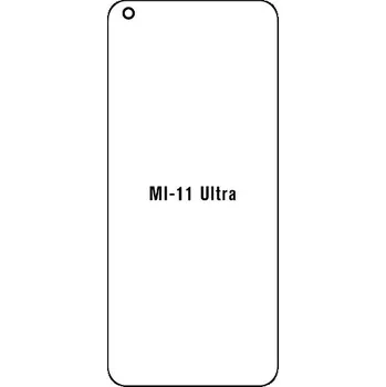 engaroGuard Hydrogel - ochranná fólie - Xiaomi Mi 11 Ultra průsvitná nepoužívám kryt = folie na celý displej 1 kus s výřezem přední kamery