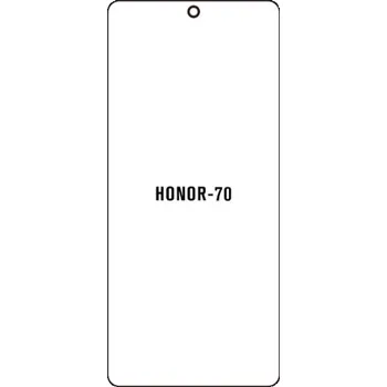 engaroGuard Hydrogel - ochranná fólie - Honor 70 průsvitná nepoužívám kryt = folie na celý displej 1 kus s výřezem přední kamery