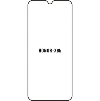 engaroGuard Hydrogel - ochranná fólie - Honor X6b průsvitná nepoužívám kryt = folie na celý displej 1 kus s výřezem přední kamery