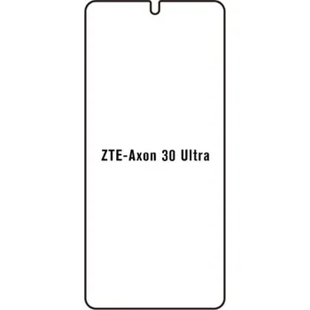 engaroGuard Hydrogel - ochranná fólie - ZTE Axon 30 Ultra průsvitná nepoužívám kryt = folie na celý displej 1 kus s výřezem přední kamery