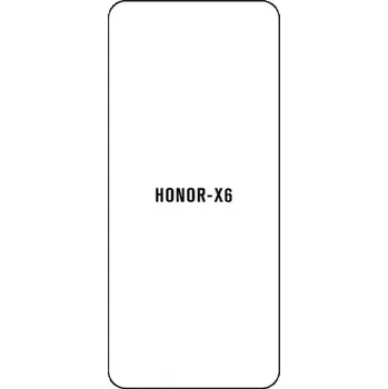 engaroGuard Hydrogel - ochranná fólie - Honor X6 průsvitná nepoužívám kryt = folie na celý displej 1 kus s výřezem přední kamery