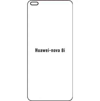 engaroGuard Hydrogel - ochranná fólie - Huawei Nova 8i průsvitná nepoužívám kryt = folie na celý displej 1 kus s výřezem přední kamery