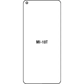 engaroGuard Hydrogel - ochranná fólie - Xiaomi Mi 10T 5G průsvitná nepoužívám kryt = folie na celý displej 1 kus s výřezem přední kamery